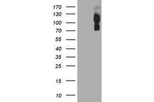 HEK293T cells were transfected with the pCMV6-ENTRY control (Left lane) or pCMV6-ENTRY ENPEP (Right lane) cDNA for 48 hrs and lysed. (ENPEP 抗体)