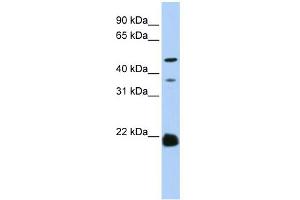 WB Suggested Anti-ZDHHC14 Antibody Titration:  0. (ZDHHC14 抗体  (N-Term))