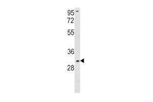 Western blot analysis of SOD3 Antibody (N-term) (ABIN390857 and ABIN2841079) in K562 cell line lysates (35 μg/lane). (SOD3 抗体  (N-Term))