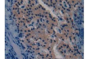 Immunohistochemistry (IHC) image for anti-Spondin 1 (SPON1) (AA 608-802) antibody (ABIN7440035)