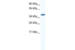 WB Suggested Anti-ZFP36L1 Antibody Titration: 0. (ZFP36L1 抗体  (N-Term))