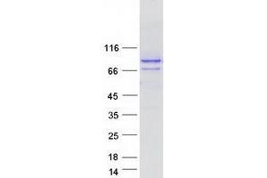 Western Blotting (WB) image for Spastic Paraplegia 20 (Troyer Syndrome) (SPG20) (Transcript Variant 2) protein (Myc-DYKDDDDK Tag) (ABIN2732510)