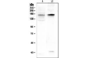 Western blot analysis of KCNH1 using anti-KCNH1 antibody (ABIN6719590).