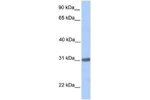 WB Suggested Anti-C7orf61 Antibody Titration: 0. (C7orf61 抗体  (C-Term))