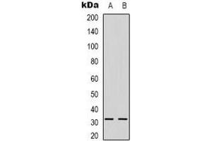 Western blot analysis of NGF beta expression in Raji (A), HepG2 (B) whole cell lysates. (NGFB 抗体)