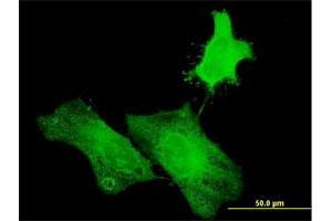 Immunofluorescence of purified MaxPab antibody to H1FOO on HeLa cell. (H1FOO 抗体  (AA 1-207))