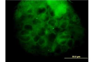 Immunofluorescence of monoclonal antibody to MVD on A-431 cell. (MVD 抗体  (AA 301-398))