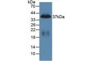 Western blot analysis of recombinant Mouse PP. (PPY 抗体  (AA 31-97))