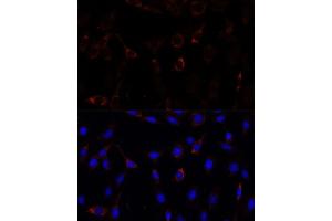 Immunofluorescence analysis of C6 cells using RNF112 antibody (ABIN7270054) at dilution of 1:100. (RNF112 抗体  (AA 200-500))