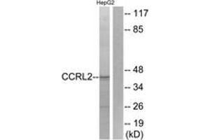 Western blot analysis of extracts from HepG2 cells, using CCRL2 Antibody.