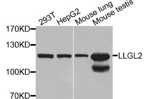 Western blot analysis of extracts of various cell lines, using LLGL2 antibody. (LLGL2 抗体)