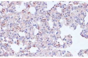 Immunohistochemistry of paraffin-embedded Rat lung using CD18 Polyclonal Antibody at dilution of 1:100 (40x lens).