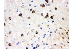 Anti- SSH3BP1 Picoband antibody, IHC(P) IHC(P): Mouse Brain Tissue (ABI1 抗体  (N-Term))