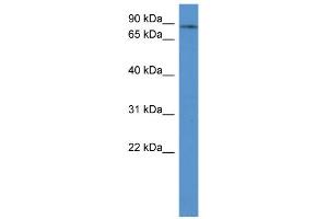 WB Suggested Anti-ADD3 Antibody Titration: 0.