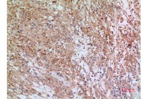 Immunohistochemistry (IHC) analysis of paraffin-embedded Human Brain, antibody was diluted at 1:100. (INHBB 抗体  (C-Term))