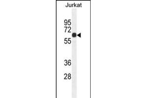 CCDC8 Antibody (C-term) (ABIN654511 and ABIN2844238) western blot analysis in Jurkat cell line lysates (35 μg/lane).