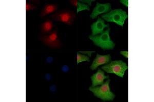 ABIN6256503 and ABIN6267060 staining Hela cells by IF/ICC. (ERK1/2 抗体  (pThr202, pTyr204))