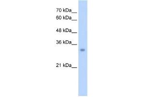 WB Suggested Anti-ECH1 Antibody Titration:  2. (ECH1 抗体  (N-Term))