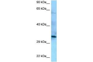 WB Suggested Anti-PPP6C Antibody Titration: 1. (PPP6C 抗体  (N-Term))