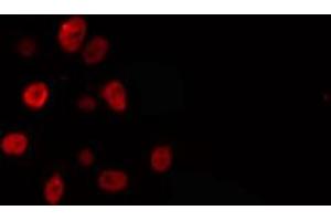 ABIN6274294 staining Hela cells by IF/ICC. (ELL 抗体  (Internal Region))
