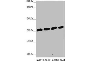 Western blot All lanes: ANKRD1 antibody at 1. (ANKRD1 抗体  (AA 1-130))