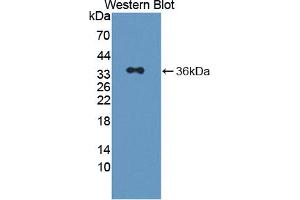 Western blot analysis of the recombinant protein. (Pirin 抗体  (AA 1-290))