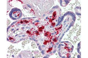 Anti-F13A1 / Factor XIIIa antibody IHC of human placenta. (F13A1 抗体)
