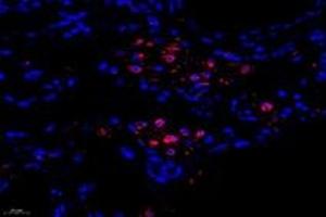 Immunofluorescent analysis of paraformaldehyde-fixed human lung using,FLJ22167 (ABIN7073961) at dilution of 1: 1400 (FLJ22167 抗体)