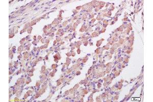 Formalin-fixed and paraffin embedded mouse embryo labeled with Anti-RNF123 Polyclonal Antibody, Unconjugated  at 1:200 followed by conjugation to the secondary antibody and DAB staining (RNF123 抗体  (AA 2-52))