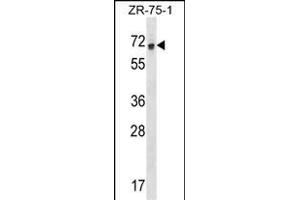 RCOR1 Antibody (N-term) (ABIN1538927 and ABIN2848670) western blot analysis in ZR-75-1 cell line lysates (35 μg/lane). (CoREST 抗体  (N-Term))