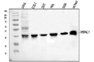Western blot analysis of MBNL1 using anti-MBNL1 antibody (ABIN7602608).