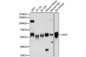 Western blot analysis of extracts of various cell lines, using PEPD antibody. (PEPD 抗体  (AA 288-424))