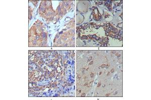 Immunohistochemistry (IHC) image for anti-Wingless-Type MMTV Integration Site Family, Member 5A (WNT5A) antibody (ABIN969460)