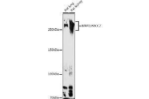 Western blot analysis of extracts of various cell lines, using MRP2/ antibody (ABIN6129853, ABIN6136357, ABIN6136358 and ABIN6224455) at 1:1000 dilution. (ABCC2 抗体  (AA 180-315))