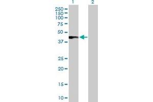 Western Blot analysis of IFNAR2 expression in transfected 293T cell line by IFNAR2 MaxPab polyclonal antibody. (IFNAR2 抗体  (AA 1-331))