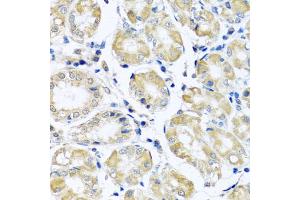 Immunohistochemistry of paraffin-embedded human stomach using NDUFB10 antibody (ABIN5972156) at dilution of 1/100 (40x lens). (NDUFB10 抗体)