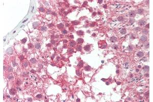 Rabbit Anti-BRD4 antibody  Formalin Fixed Paraffin Embedded Tissue: Human Testis Primary antibody Concentration: 1:100 Secondary Antibody: Donkey anti-Rabbit-Cy3 Secondary Antibody Concentration: 1:200 Magnification: 20x Exposure Time: 0. (BRDT 抗体  (N-Term))