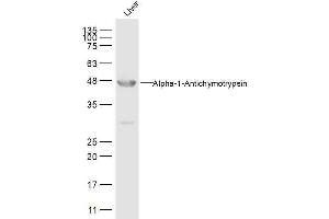 Liver lysates probed withAACT Alpha1 Polyclonal Antibody, Unconjugated  at 1:500 dilution and 4˚C overnight incubation. (SERPINA3 抗体  (AA 121-320))