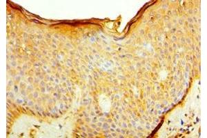 Immunohistochemistry of paraffin-embedded human skin tissue using ABIN7156926 at dilution of 1:100 (IL7R 抗体  (AA 21-239))