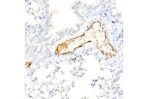Immunohistochemistry of paraffin-embedded Mouse lung using von Willebrand factor (VWF) antibody (ABIN7271339) at dilution of 1:800 (40x lens). (VWF 抗体)