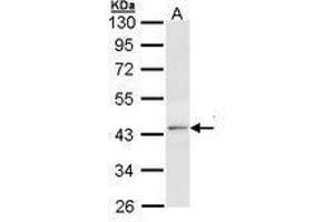Image no. 2 for anti-Thyroid Hormone Receptor, beta (THRB) (AA 1-169) antibody (ABIN467595) (THRB 抗体  (AA 1-169))