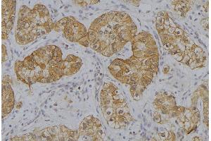 ABIN6273634 at 1/100 staining Human uterus tissue by IHC-P. (HSP77/76 抗体)