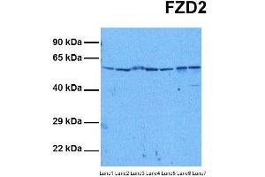 Host:  Rabbit  Target Name:  FZD2  Sample Tissue:  Human HepG2, Human Jurkat, Human MCF7, Human DLD1, Human Hela, Human Fetal Liver, Human Stomach Tumor  Antibody Dilution:  1. (FZD2 抗体  (N-Term))