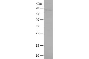 NAD-ME Protein (AA 19-584) (His tag)