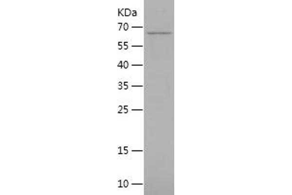 NAD-ME Protein (AA 19-584) (His tag)