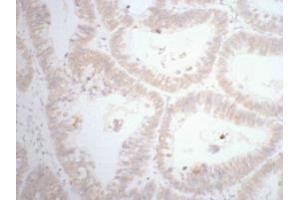 Immunohistochemistry (IHC) image for anti-Caudal Type Homeobox 2 (CDX2) antibody (ABIN7189168)