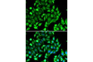 Immunofluorescence analysis of U20S cell using STAT4 antibody. (STAT4 抗体)