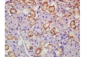 Formalin-fixed and paraffin embedded rat lymph node labeled with Rabbit Anti-Axin 2 Polyclonal Antibody, Unconjugated  at 1:200 followed by conjugation to the secondary antibody and DAB staining (AXIN2 抗体  (AA 331-430))