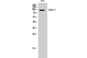 Western Blotting (WB) image for anti-Fibroblast Growth Factor Receptor 3 (FGFR3) (Internal Region) antibody (ABIN6280668)