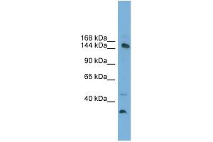 WB Suggested Anti-MED14  Antibody Titration: 0. (MED14 抗体  (Middle Region))